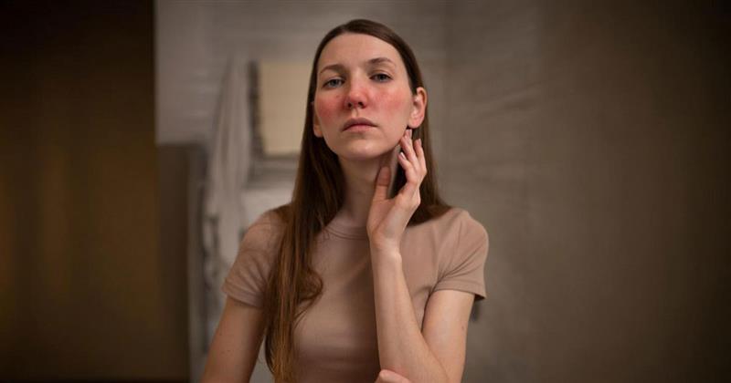 skin picking disorder